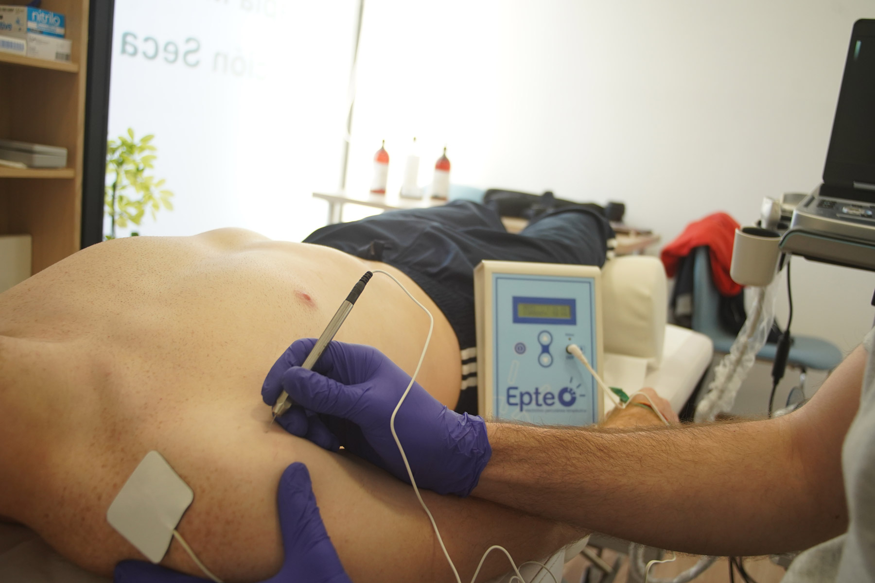 Fisioterapia Invasiva
